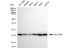 Western blotting analysis using NDUFB9 antibody (ABIN7799553). (Rekombinanter NDUFB9 Antikörper)