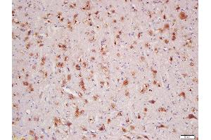 Formalin-fixed and paraffin embedded rat brain labeled with Rabbit Anti-HER4/ErbB4 Polyclonal Antibody, Unconjugated  at 1:200 followed by conjugation to the secondary antibody and DAB staining (ERBB4 Antikörper  (AA 451-550))