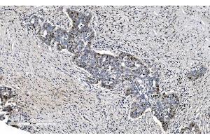 IHC analysis of MCM6 using anti-MCM6 antibody (ABIN7600036). (MCM6 Antikörper  (AA 14-821))