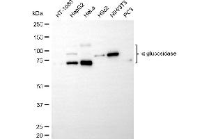Western blotting analysis using alpha glucosidase antibody (ABIN7797585). (Rekombinanter AGLU Antikörper)