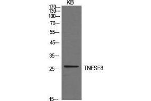 Western Blot (WB) analysis of KB cells using CD30-L Polyclonal Antibody. (TNFSF8 Antikörper  (Internal Region))