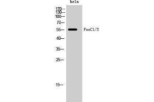 Western Blotting (WB) image for anti-Forkhead Box C1 (FOXC1) (Internal Region) antibody (ABIN3184652)