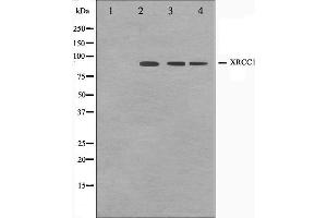 Western blot analysis on Jurkat,COS7 and HuvEc cell lysate using XRCC1 Antibody. (XRCC1 Antikörper)