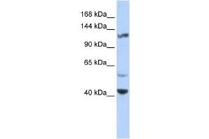 KCNH3 antibody used at 1 ug/ml to detect target protein. (KCNH3 Antikörper)