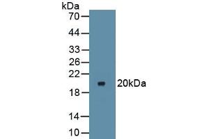 Detection of Recombinant IkBa, Mouse using Polyclonal Antibody to Inhibitory Subunit Of NF Kappa B Alpha (IkBa) (Inhibitory Subunit Of NF kappa B alpha Antikörper)