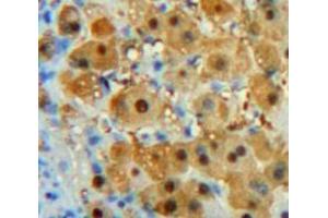 Used in DAB staining on fromalin fixed paraffin-embedded Liver tissue (PDGFC Antikörper  (AA 23-345))