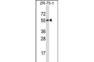 RORB anticorps  (C-Term)