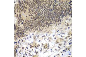 Immunohistochemistry (Paraffin-embedded Sections) (IHC (p)) image for anti-CCAAT/enhancer Binding Protein (C/EBP), gamma (CEBPG) (AA 1-150) antibody (ABIN6138388)