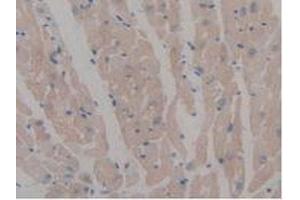 IHC-P analysis of Mouse Heart Tissue, with DAB staining. (MAP6 Antikörper  (AA 177-387))