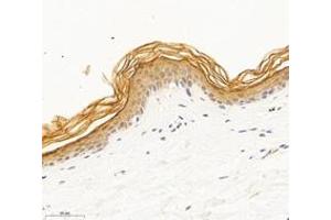 Immunohistochemistry analysis of paraffin-embedded mouse skin using,DSP (ABIN7073719) at dilution of 1: 1000