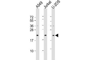 All lanes : Anti-FP24 Antibody (N-Term) at 1:1000-1:2000 dilution Lane 1: A549 whole cell lysate Lane 2: Jurkat whole cell lysate Lane 3: U-2OS whole cell lysate Lysates/proteins at 20 μg per lane. (FAAP24 Antikörper  (AA 1-32))