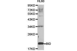 Western Blotting (WB) image for anti-BH3 Interacting Domain Death Agonist (BID) antibody (ABIN1871288) (BID Antikörper)