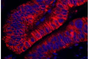 anti-rho Guanine Nucleotide Exchange Factor (GEF) 5 (ARHGEF5) (AA 600-650) antibody