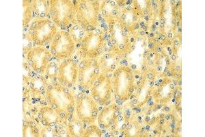 Immunohistochemistry of paraffin-embedded Mouse kidney using PDE4DIP Polyclonal Antibody at dilution of 1:100 (40x lens). (PDE4DIP Antikörper)