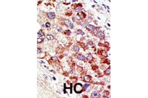 Immunohistochemistry (IHC) image for anti-Cbl proto-oncogene C (CBLC) antibody (ABIN2996831) (CBLC Antikörper)