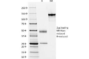 SDS-PAGE Analysis Purified Elastin Mouse Monoclonal Antibody (ELN/1981). (Elastin Antikörper)