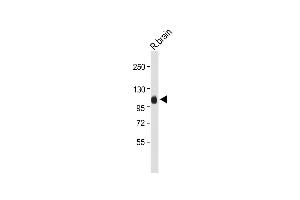 Anti-G Antibody (Center) at 1:2000 dilution + Rat brain whole tissue lysate Lysates/proteins at 20 μg per lane. (MAG Antikörper  (AA 439-466))