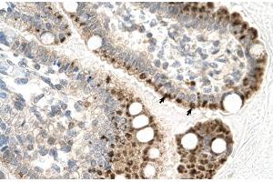 Rabbit Anti-ZFP1 Antibody Catalog Number: ARP31586 Paraffin Embedded Tissue: Human Intestine Cellular Data: Epithelial cells of intestinal villas Antibody Concentration: 4. (Zfp-1 Antikörper  (N-Term))
