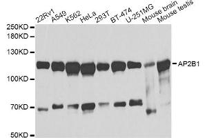 Western blot analysis of extracts of various cell lines, using AP2B1 antibody (ABIN1871002) at 1:1000 dilution. (AP2B1 Antikörper)