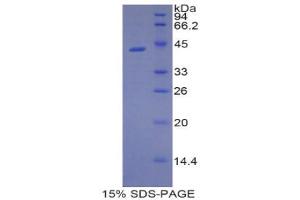 SDS-PAGE (SDS) image for Lipocalin 9 (LCN9) (AA 33-163) protein (His tag,GST tag) (ABIN1877379) (LCN9 Protein (AA 33-163) (His tag,GST tag))