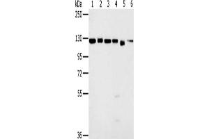 Gel: 6 % SDS-PAGE, Lysate: 40 μg, Lane 1-6: 293T cells, K562 cells, hela cells, 231 cells, Jurkat cells, NIH/3T3 cells, Primary antibody: ABIN7130189(MATR3 Antibody) at dilution 1/500, Secondary antibody: Goat anti rabbit IgG at 1/8000 dilution, Exposure time: 3 seconds (MATR3 Antikörper)