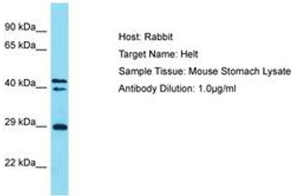 HELT Antikörper  (AA 138-187)