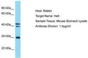 Image no. 1 for anti-Helt BHLH Transcription Factor (HELT) (AA 138-187) antibody (ABIN6750287) (HELT Antikörper  (AA 138-187))