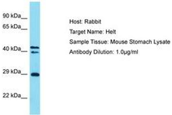 HELT antibody  (AA 138-187)