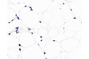 Immunohistochemistry analysis of paraffin-embedded rat adipose tissue using PPARG Monoclonal Antibody at dilution of 1:1000. (PPARG Antikörper)