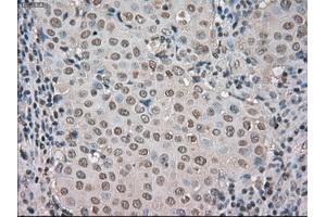 Image no. 3 for anti-Budding Uninhibited By Benzimidazoles 1 Homolog beta (Yeast) (BUB1B) antibody (ABIN1497000) (BUB1B Antikörper)