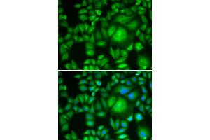 Immunofluorescence analysis of HeLa cells using CBR1 antibody (ABIN5973163). (CBR1 Antikörper)
