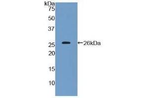 Detection of Recombinant CD200, Human using Polyclonal Antibody to Cluster Of Differentiation 200 (CD200) (CD200 Antikörper  (AA 31-232))
