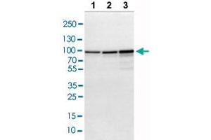 Western blot analysis of Lane 1: NIH-3T3 cell lysate, Lane 2: NBT-II cell lysate, Lane 3: PC12 cell lysate with ACO2 polyclonal antibody .