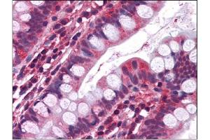 Immunohistochemistry Image: Human Small Intestine: Formalin-Fixed, Paraffin-Embedded (FFPE) (Serotonin Receptor 3A Antikörper  (Internal Region))