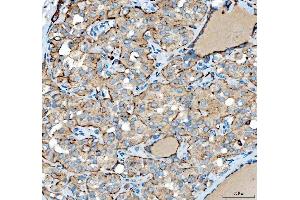 IHC analysis of SIAE using anti-SIAE antibody (ABIN7600774). (SIAE Antikörper  (AA 230-523))