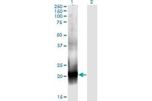 Western Blot analysis of RAC2 expression in transfected 293T cell line by RAC2 monoclonal antibody (M08), clone 3B8.