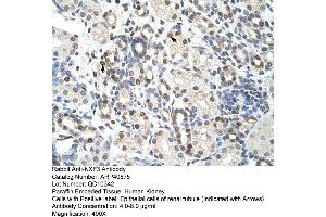Rabbit Anti-NXF3 Antibody  Paraffin Embedded Tissue: Human Kidney Cellular Data: Epithelial cells of renal tubule Antibody Concentration: 4. (NXF3 Antikörper  (C-Term))