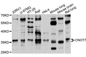 Western blot analysis of extracts of various cell lines, using CNOT7 antibody (ABIN5995835) at 1/1000 dilution. (CNOT7 Antikörper)