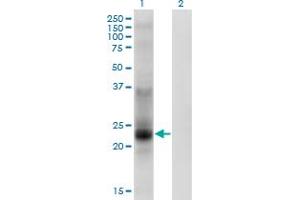 Western Blot analysis of TSPAN8 expression in transfected 293T cell line by TSPAN8 monoclonal antibody (M02), clone 1E5. (Tspan-8 Antikörper  (AA 110-205))