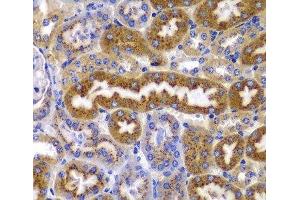 Immunohistochemistry of paraffin-embedded Mouse kidney using PRKAB1 Polyclonal Antibody at dilution of 1:100 (40x lens). (PRKAB1 Antikörper)