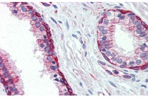 Immunohistochemistry with Human Prostate lysate tissue at an antibody concentration of 5. (UBE2L3 Antikörper  (C-Term))
