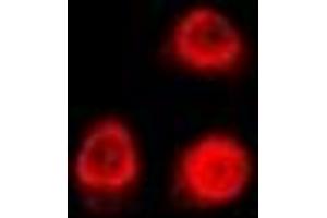 Immunofluorescent analysis of Uev1A staining in U2OS cells. (UBE2V1 Antikörper)