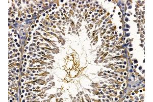 ABIN6257296 and ABIN6275747 at 1/100 staining rat testis tissue by IHC-P.