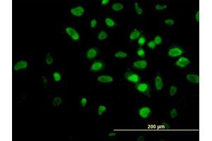 Immunofluorescence of monoclonal antibody to AKT2 on HeLa cell.