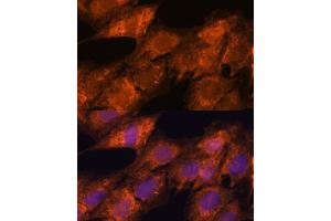 Immunofluorescence analysis of C6 cells using IPO4 antibody  at dilution of 1:100. (Importin 4 Antikörper  (AA 728-1081))