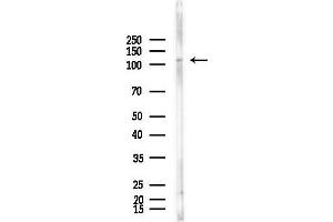 anti-Fibroblast Growth Factor Receptor 1 (FGFR1) (pTyr766) antibody