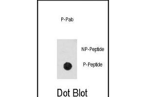 Dot blot analysis of anti-Phospho-CDK2-pT14 Antibody (ABIN389996 and ABIN2839773) on nitrocellulose membrane.