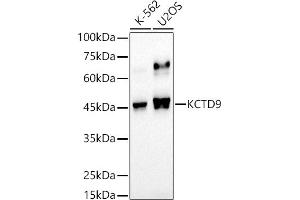 Western blot analysis of extracts of various cell lines, using KCTD9 antibody (ABIN7269469) at 1:500 dilution. (KCTD9 Antikörper)