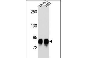 POMT1 antibody  (C-Term)