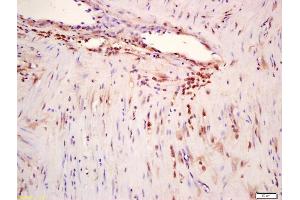 Formalin-fixed and paraffin embedded human myometrium labeled with Anti-phospho-ERK5 (Ser496) Polyclonal Antibody, Unconjugated (ABIN710246) at 1:200 followed by conjugation to the secondary antibody and DAB staining